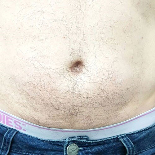 הסרת שיער — before